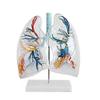 2 Times Larger Human Anatomical Bronchial Tree with Larynx and Transparent Lung Segment Demonstration Model view 4